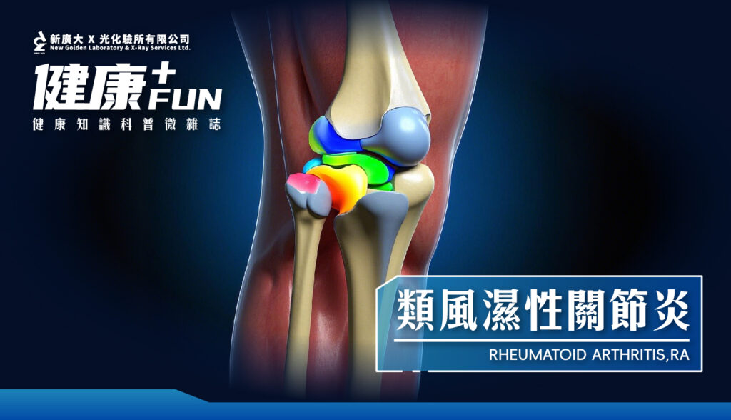 類風濕性關節炎（Rheumatoid Arthritis, RA）