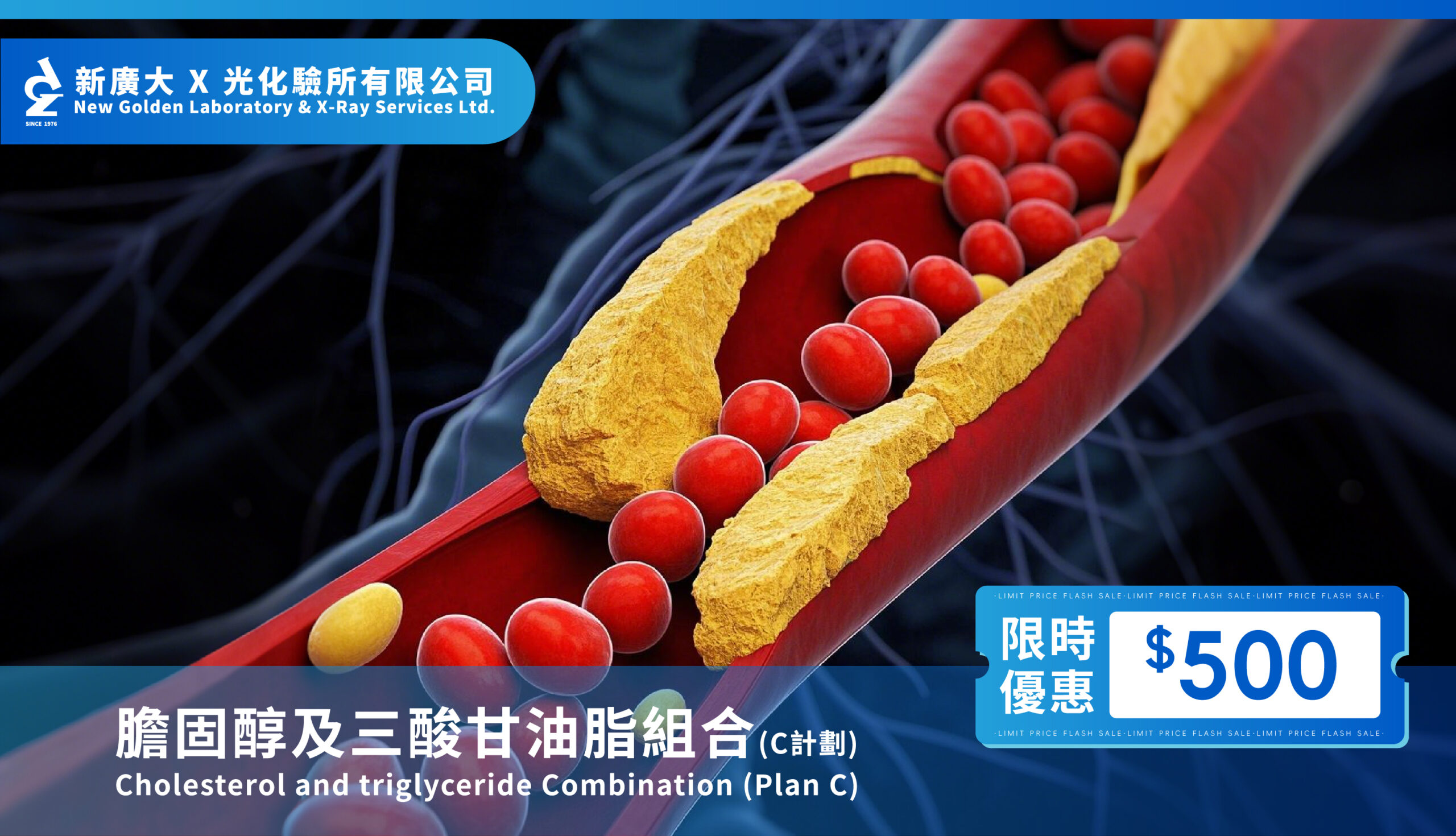 【關注血脂健康】C計劃血脂檢測只需 $500,守護心臟未來!
